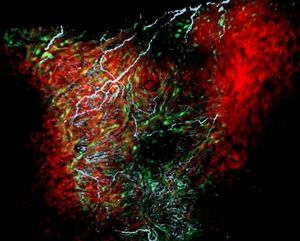 Zellklumpen im Herzmuskel: Der neue Typ leuchtet grün (Foto: nd.edu)