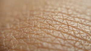 Haut: zusammen mit Ozon ein Umweltproblem (Foto: Montavius Howard, pixabay.com)