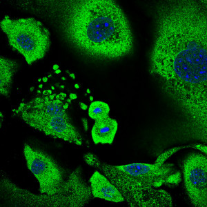 Hautzellen: Körper wehrt sich gegen Krebs (Foto: Annagiulia Ciocia, crg.eu)