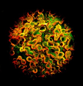 Goldnanopartikel in einem neu entwickelten porösen Hydrogel (Foto:  Katja Buder, uni-mainz.de)