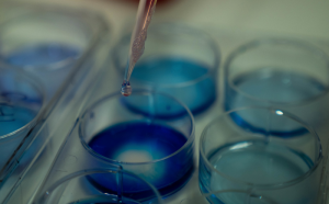 Experimente im Labor: wichtiger Fortschritt für Lupus-Forschung (Foto: Tracey Nearmy, anu.edu.au)