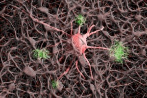 Nervenzellen. Diese werden bei Alzheimer geschädigt (Bild: Gerd Altmann, pixabay.com)
