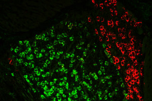 Grün eingefärbt: die Zone des Kurzzeitgedächtnisses (Foto: Dheeraj Roy, Ying Zhang, mit.edu)