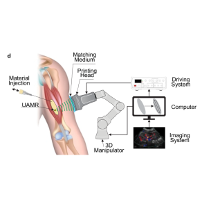 So könnten Implantate eines Tages vor Ort gedruckt werden (Bild: concordia.ca)