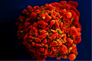 HI-Virus: Infektion beschleunigt die Alterung in erheblichem Ausmaß (Foto: niaid.nih.gov)