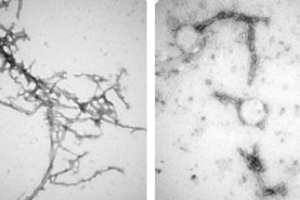 Fehlgefaltetes (links) und entwirrtes Protein (Fotos: Xiaobo Mao, hopkinsmedicine.org)