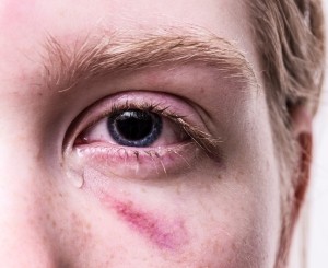 Gewaltopfer: emotionale Vernachlässigung ist weitverbreitet (Foto: pixabay.com, Anemone123)