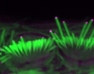 Unter dem Mikroskop: Haarzellen, die das Hören ermöglichen (Foto: salk.edu)