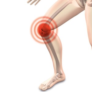 Knie: Meniskus-Probleme verlieren ihren Schrecken (Illustration: naturwohl-gesundheit, pixabay.com)