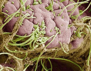Fadenförmige Bakterien im Darm-Mikrobiom: wichtig für Körperfunktionen (Bild: cuimc.columbia.edu)