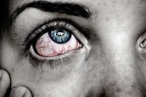 Trockenes Auge: Brennen und Rötungen sind hierbei keine Seltenheit (Foto: pixabay.com, agnes)