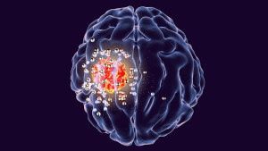 Aktivierter Wärmegenerator: soll das Tumorgewebe im Gehirn erhitzen (Bild: Hamed Arami/stanford.edu)