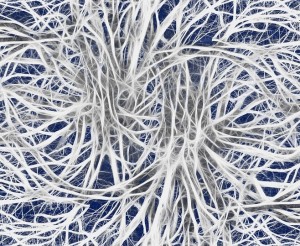 Neuronen: Zelltod zerstört Kognition als Ursache von Parkinson (Foto: pixabay.com, Gerd Altmann)