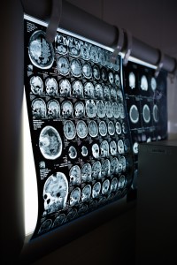 Gehirn-Scans: Deep Learning weist Alzheimer nach (Foto: pixabay.com, Dmitriy Gutarev)