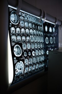 Gehirn-Scans: COVID-19 verändert nicht nur die Lunge (Foto: pixabay.com, Dmitriy Gutarev)
