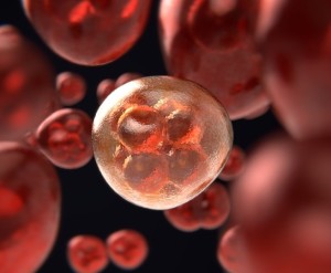Sich bildender Tumor: Neues Ultraschall-Verfahren wirkt hocheffektiv (Bild: ColiN00B, pixabay.com)
