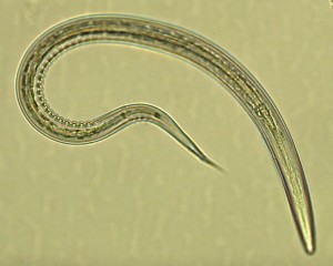 Hakenwurm unter dem Mikroskop: infektiös, aber durchaus hilfreich (Foto: jcu.edu.au)