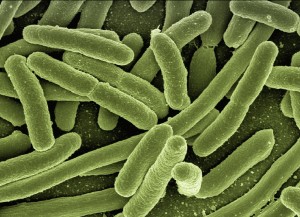 E. coli: keine einfache Antwort auf Entstehung von Resistenzen (Foto: pixabay.com, Gerd Altmann)