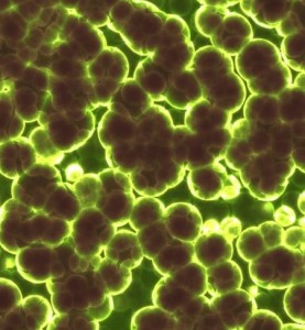 Unter dem Mikroskop: Kunststoffe bilden Schlaraffenland für Bakterien (Bild: Prawny, pixabay.com)