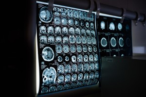 Gehirn-Scans: neuer Behandlungsansatz für Psyche (Foto: pixabay.com, Dmitriy Gutarev)