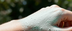 Zeolith hilft bei Hautkrankheiten - ohne Chemie (Copyright: ZEOLITH WISSEN)