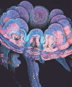 Querschnitt Korallenpolyp: Methode des 