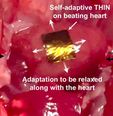 Signalfolie auf dem schlagenden Herzen (Quelle: Institute for Basic Science)