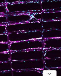 Mit einem Gerüst lassen sich Muskelfasern regenerieren (Foto: hettiaratchi-lab.com)