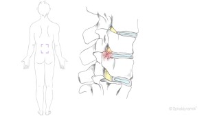 Schmerzfrei & beweglich (Bild: Spiraldynamik®)