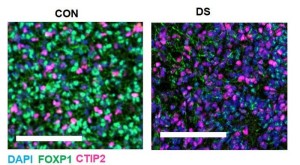 Down-Syndrome: Deutliche Unterschiede im Gehirn (Foto: Michael Lattke, imperial.ac.uk)