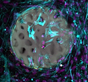 Knochenbildende Zellen (violett) besiedeln neues Hydrogel (Foto: ethz.ch, Margherita Bernero)