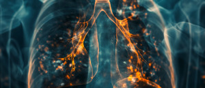 COPD entsteht auch durch Umweltbelastungen (Copyright: ZEOLITH WISSEN)