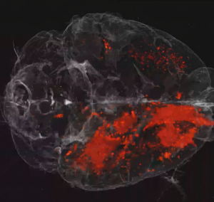 Menschliches Gehirn, das von Viren (rot) befallen ist (Illustration: rockefeller.edu)
