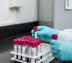 Bluttest: Methode erkennt Alzheimer bei Gendefekt präzise (Foto: pixabay.com, fernando zhiminaicela)