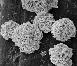 Elektronenmikroskopisches Bild des Katalysators (Foto: ethz.ch, Debasis Maity)